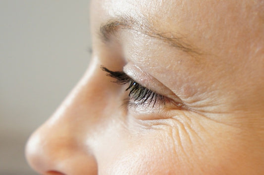 How to get rid of mimic wrinkles under the eyes?